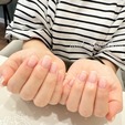 ハンドネイル